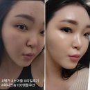 래디언팀 - 부산진구 서전로 8 | 인셀덤쿠션 커버쿠션 쌩카쌩리얼후기/래디언솜100앰플쿠션ㅇㅇ노어플 진심후기❤️