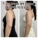 일상이상 | 교대 숫자병원 ㅇㅈㅈ 원장님 팔뚝 무한람스(통증/바본/멍/일상/후기)