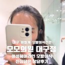 메타의원 | 대구 여자 헤어라인 모발이식 모모의원 대구점 상담후기 - 상담비무료/광고아님/여자모발이식/남자탈모...