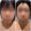 GS25광명휴게소점 | 광명피부관리 루아르에스테틱 윤곽관리 진정관리 솔직후기