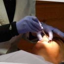 서울더플랜치과의원 | 충치가 생기지 않는 생활습관을 위한 실제 체험 후기