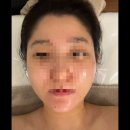 [라즈뮤에스테틱] 스킨 컨설팅과 문제성 피부 윤곽관리 후기