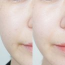 365행복케어 | 7일 만에 체감되는 피부 모공 줄이는 관리법! 에스트라 리제덤 365 모공 탄력 캡슐세럼