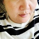 안면약국 | [리프팅앰플] 닥터 투라 셀톡스 리페어 앰플 솔직 후기｜안면 리프팅 효과 제대로 느낀 광채 앰플