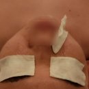 비움&채움뷰티센타 | 고양피부관리 얼굴을 환하게 가꿔주는 비법 [비움&채움뷰티센터 후기]