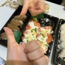 정선군보건소구절진료소 | 담낭 절제술 후기... (20대 여자 담석증&amp;담낭염)