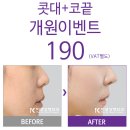 더코성형외과 이미지