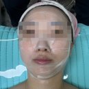 헬프미 에스테틱 | 의정부 에스테틱 헬프미에스테틱 하이푸 리프팅 물방울 리프팅 후기 ♥
