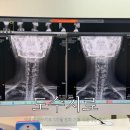 양재굿본재활의학과의원 | 양재역 도수치료 3개월 변화 기록 내돈내산 후기