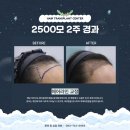 장비뇨기과의원 | 전주 탈모약 처방 병원 약보다 먼저 봐야 할 것들