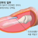 내손톱내발톱