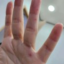 연세박세진의원 | 구반포역 정형외과 전문병원 추천 5곳 어깨 | 손가락 | 목 | 관절 | 무릎