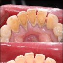 이봄치과 이미지