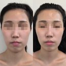 쌍용1차(아) | [천안] 천안윤곽관리 전문 이화에스테틱 천안점 후기