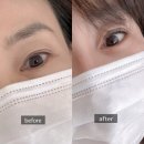 패스트카페동탄2서영아너시티 | [공지] 비엘래쉬 (BL Lashes) 속눈썹 연장 재료로 안전한 속눈썹 연장: 동탄 온플릭래쉬