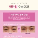 미본 이미지