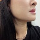 임상 농장 | 염증에 안좋은 음식 정리 및 몸속염증제거 영양제 퀘르셀 후기