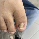 세븐일레븐 화성봉담주공점 | 화성무좀발톱 고민이라면 봉담발톱무좀 전문 관리로 해결하세요