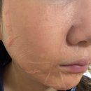 메디인 | 하늘마켓 메디인랩 A1 턴오버 마스크팩 내돈내산 후기