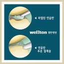 반월상연골판파열은 관절내시경으로~#십자인대파열# 이미지