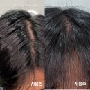 9월뷰티 - 중구 | 9월 다이소 뷰티 신상 모다모다 스칼프 샴푸 사용후기