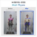 피지오테스