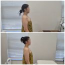 구미 산동 에스테틱 '수정뷰티' 웨딩관리 솔직 후기