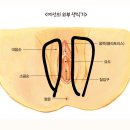 너네 생식기 여기도 털 나? 이미지