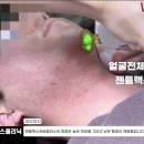 수염 때문에 스트레스라면? 수원수염제모는 원스의원에서! 젠틀맥스프로플러스 시술동영상 2025/05/09