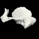 Skull-TMJ temporal bone and mandible 이미지