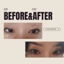 훈썹압구정