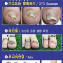 레푸스&양귀비네일 이미지