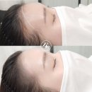 조헤어라인