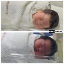 37 | 37주 응급제왕절개 후기 광진구 산부인과 SC제일산부인과에서 둘째까지! 둘째날
