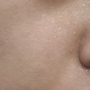 티에스 메디칼 이미지