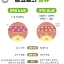 당뇨 합병증 종류 당뇨발 초기증상 치료 이미지