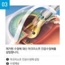 광주안과의원 이미지