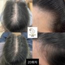 도노포레스타 두피케어(산본점)