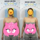 대덕대로168번길 | 대전안면비대칭 라움리포벨 안면비대칭연구소 두골비 관리 후기