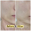 한걸음케어 | 수원 데콜테 수원광교 피부관리 리은 연말 프로그램 3D탄력 물광 케어 재방문 후기