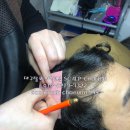 촘촘 스칼프 이미지