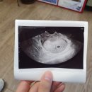 큰열매여성의원 이미지