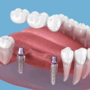 서울W(더블유)치과의원 이미지