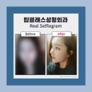 탑성형외과의원 이미지