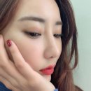 제이와이성형외과 탑스코로 매부리코교정 리얼후기!