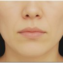 웰빙수의원 | 잠실슈링크 좋은 후기가 많으면 믿어도 되죠?에 대한 답 <의사 작성>