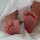 신기지 | 부산 해운대 위아더성형외과 / 17개월 아기 발바닥점 흑색종 의심 멜라닌모반 제거수술 조직검사 후기