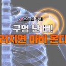 골다공증 방치하면 과다출혈을 부른다? 그 무서운 실체는? 이미지