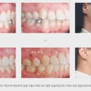 삼성스마트치과의원 이미지