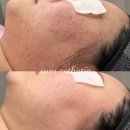 솜 에스테틱 네이버블로그